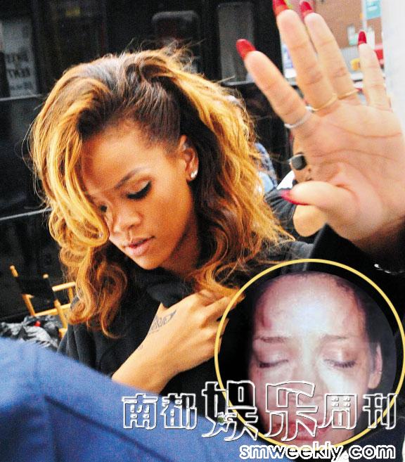 美国当红歌手蕾哈娜曾多次遭到前男友克里斯的殴打。