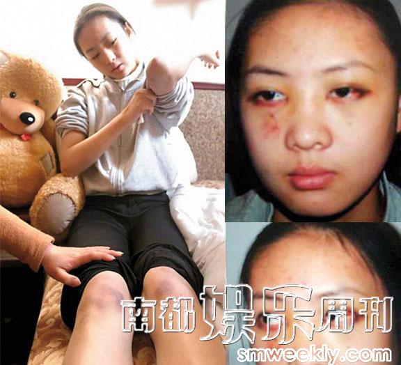 张国立之子张默殴打女友童瑶事件，曾是当年最轰动的话题。