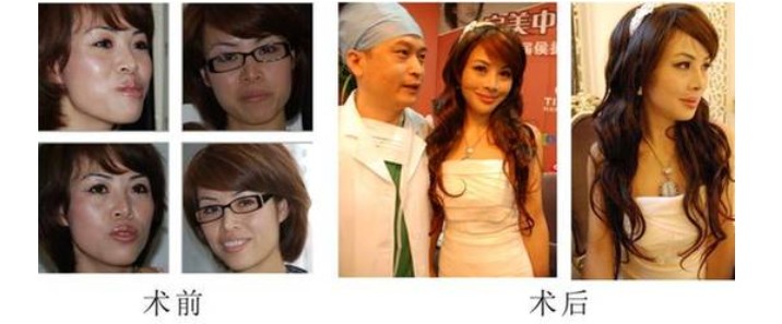 震撼的侯振杰外科正牙見證會現場
