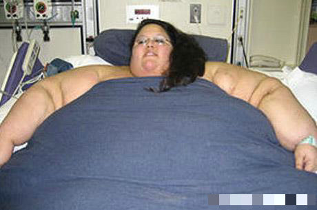 世界上最胖的女人_美国佛州女子罗莎莉 布拉德福德曾是 全世界最胖的