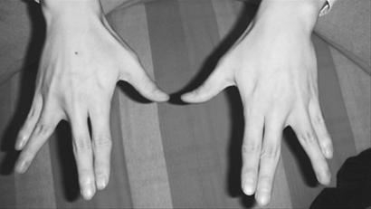腱鞘炎、鼠标手做做手指活动操(组图)