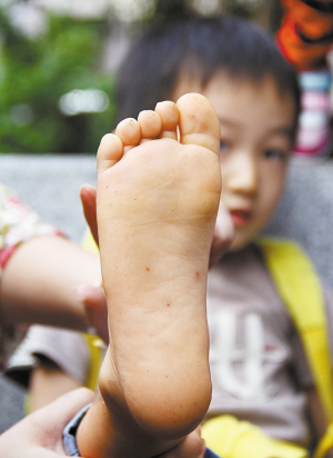 深圳女幼师扎破小孩脚板为镇得住孩子不择手段