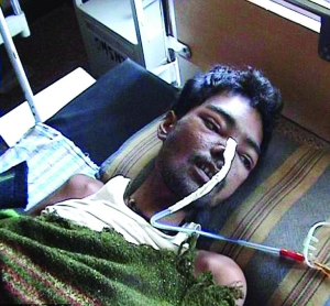 吃下6公斤金属 印男子不治身亡