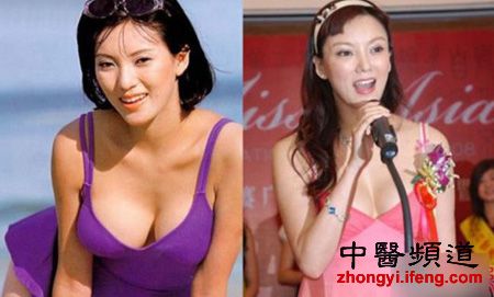 美女也老v美女胸部下垂变丑的10大美女(组图)男人女星的头上坐在图片