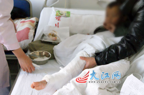 "摩托车足"是指在乘坐摩托车时,脚部伸进车轮被碾压受伤.