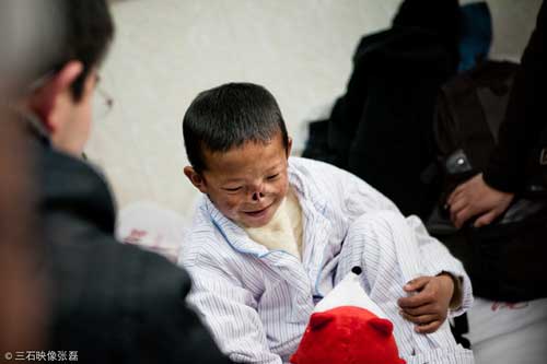 小布尼玛到北京八大处整形医院第一次就诊