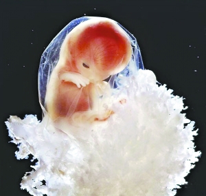 美得州孕妇堕胎前观看胎儿图像