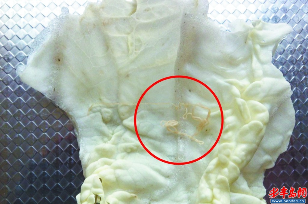 蟯虫_婴儿蛲虫病症状_宝宝有蛲虫病的表现_小儿蛲虫 ...