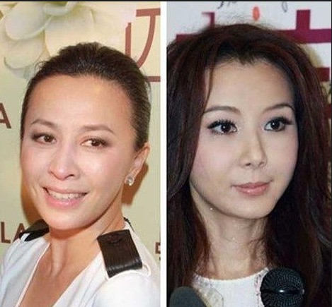 保养日久见功力 同龄女星衰老水嫩差距大(组图)