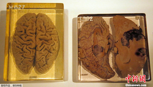 英国举办"人脑"展 爱因斯坦大脑切片亮相(图)