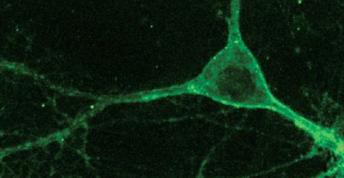 斯坦福大学教授以及生物技术公司stemcells的创始人之一欧文-韦斯曼