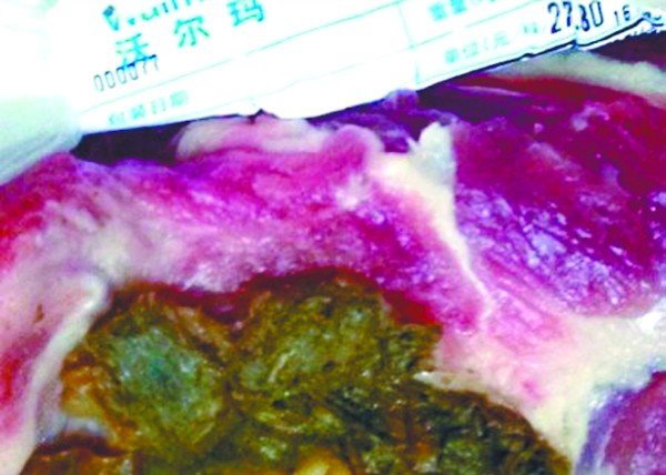沃尔玛买猪肉发现瘤状物(图)