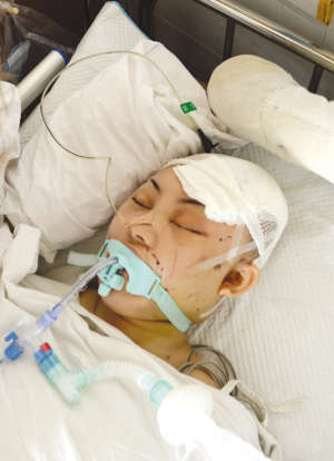 正在医院抢救的娜娜,目前已经脑死亡