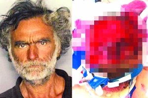 经美国警方调查:食脸男疑服过量迷幻药
