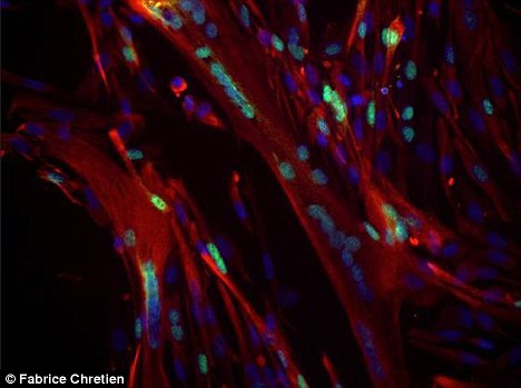突破性发现：从人体肌肉组织收集的干细胞能够在死亡之后存活17天时间