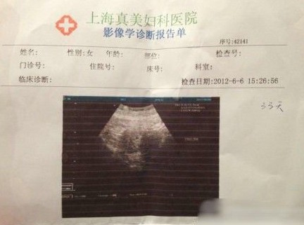 袁莉老公自曝妻子怀孕一月,并晒其b超照,称"我儿子第一张照片"