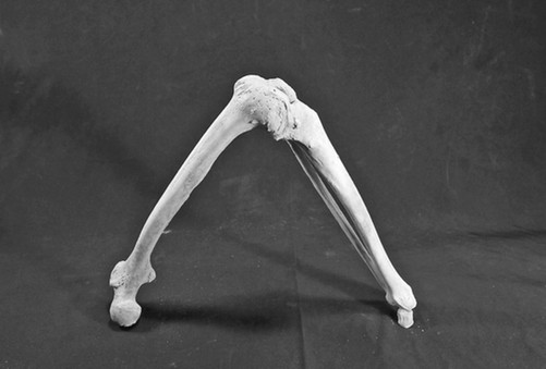 墓主人有病变的腿骨。做工精巧的假肢。资料图片