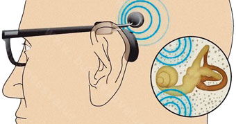 骨传导技术:用骨头听声音(图)