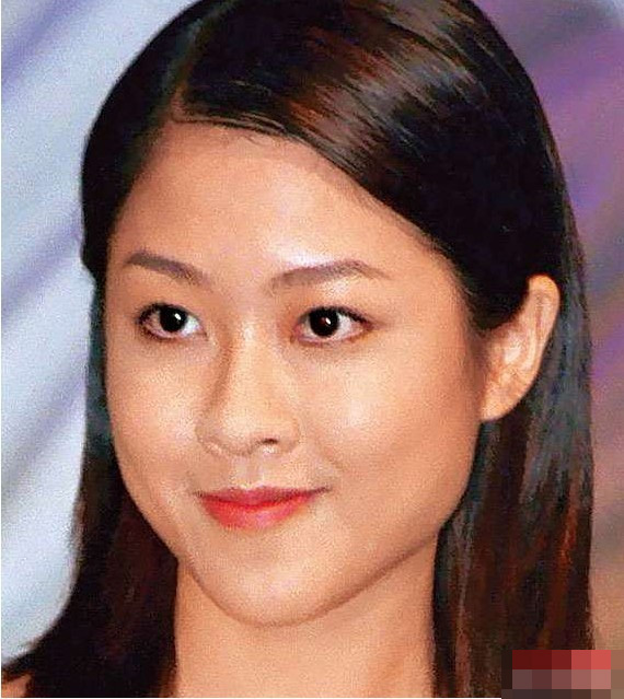 谢安琪整容后