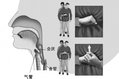 刚被噎