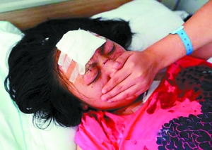 玻璃从天降割伤一女路人鼻子(图)