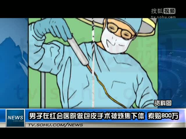 视频男子在红会医院做包皮手术被烧焦下体索赔800万