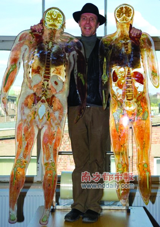 哈根斯和他的"人体世界"展览引发众多争议. 资料图片