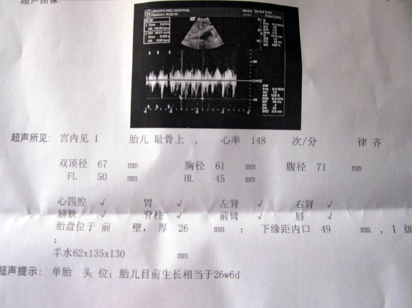 怀孕了,如何看懂胎儿B超图