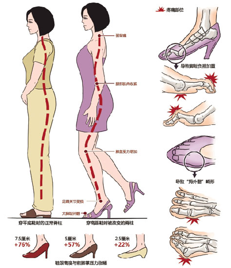 鞋底前后高度落差不要超2厘米