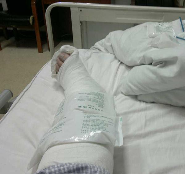 生五人制足球联赛"的热身表演赛中严重受伤,中途被抬离球场送医院治疗