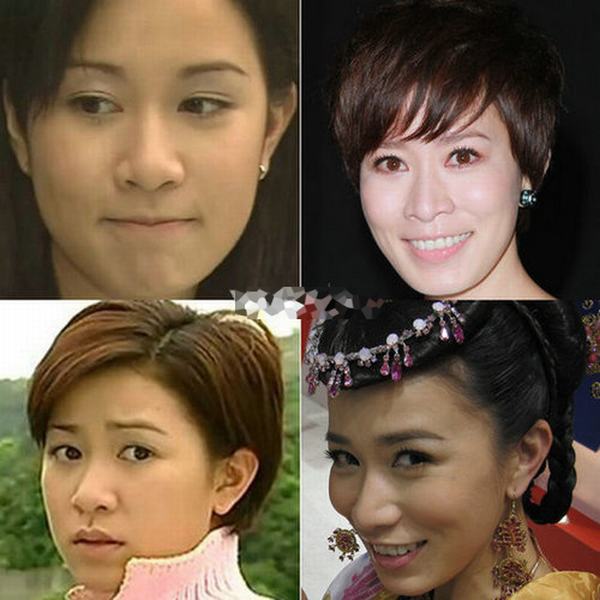 女星装嫩有妙招 奈何遭高颧骨泄底