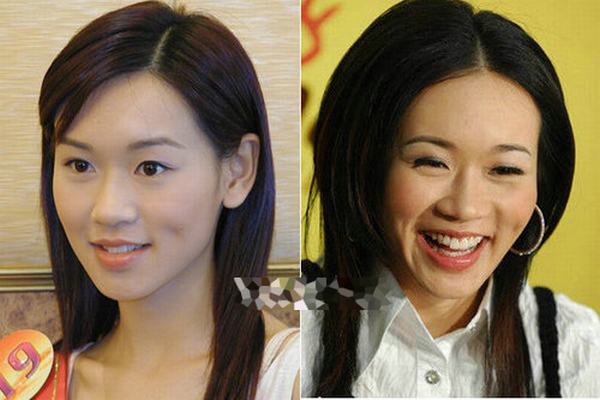 杨思琦1978年生,连女儿都生了,今年34岁了,她的颧骨自港姐的时