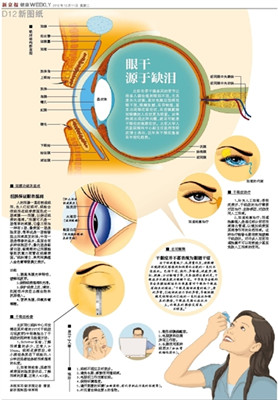 近年来干眼症患者有年轻化趋势 应多补维生素a