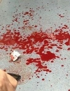 北京地铁内多名女子被刀划脸 凶手已被抓(组图)