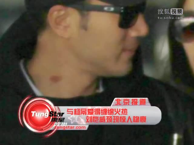 刘恺威与杨幂爱得火热颈部现惊人吻痕