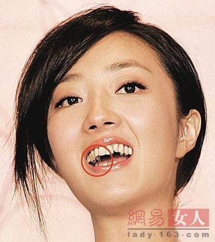 小s桂纶镁佟丽娅尹恩惠周海媚 惨遭龅牙困扰的美女明星(组图)