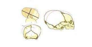 为了适应产道和骨盆形状,胎儿的头会被拉长