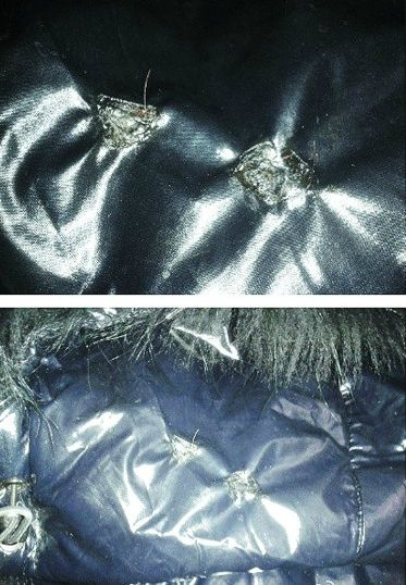 大连一个月内三名女子羽绒服帽子被塞烟头(图)