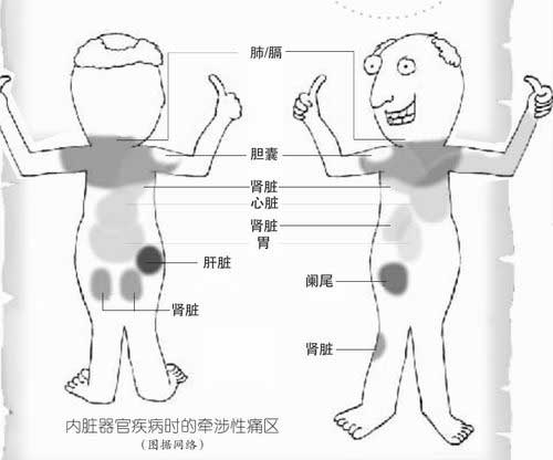 内脏器官对应疼痛图走红 网友封其"自诊宝典"