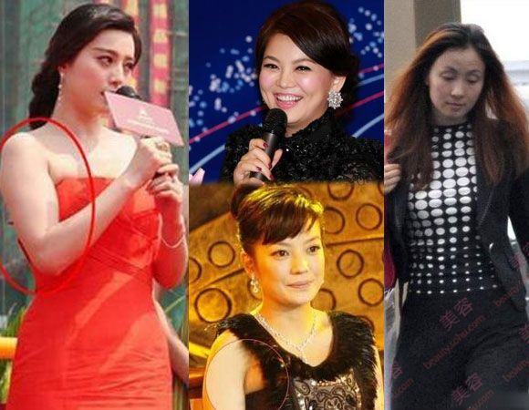 女星发福证据照 粗臂圆脸双下巴/组图