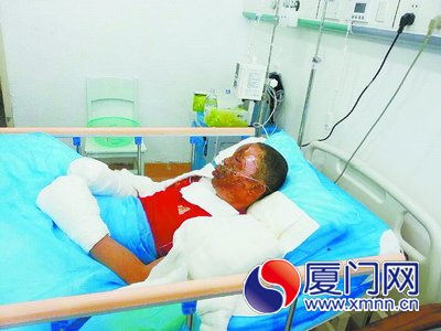 消防员爆炸瞬间眉发被烧光 满脸鲜血强忍未掉泪