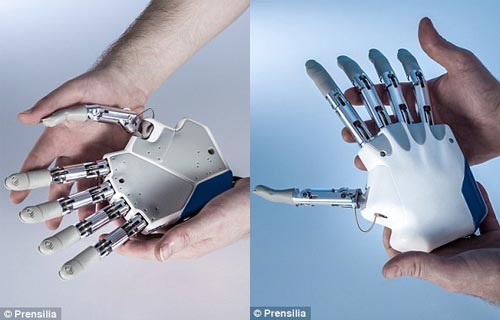 瑞士发明新型仿生学假肢 可让病人拥有