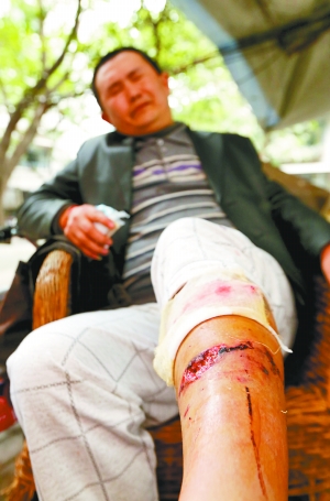 他们给赵宏川检查了伤口,从伤口来看,赵宏川腿上的弧形大口,很可能是