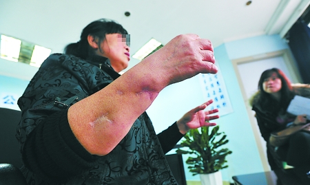 遭狗咬伤索赔18万 一审获赔6万(图)
