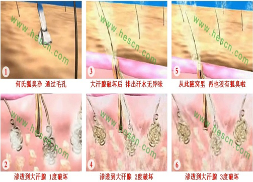 何氏狐臭净是一种无色,无味的透明液体,直接涂于腋下,不脏染衣物,不