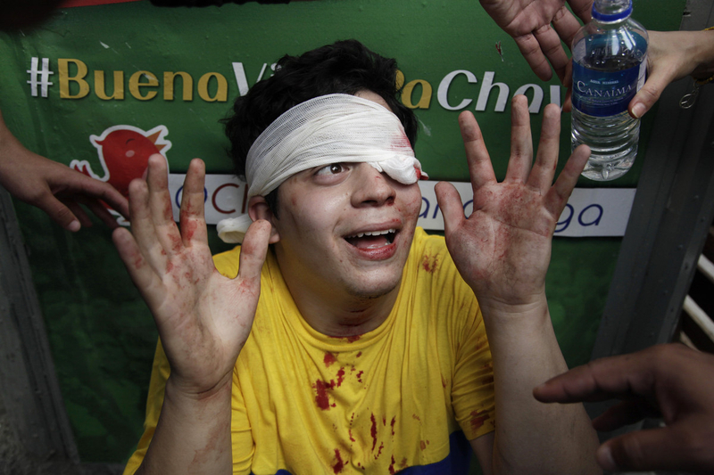 委瑞内拉支持反对派学生与查韦斯支持者发生冲