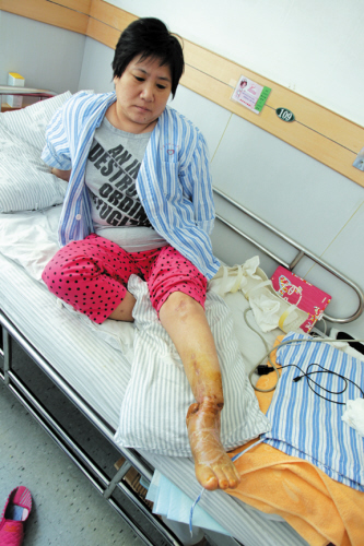 女子与逆行轿车相撞 7次大手术腿脚仍扭曲(图)