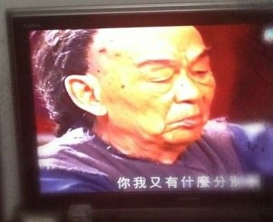 TVB83岁老戏骨颈长巨型肿瘤 乐观拍戏感动网