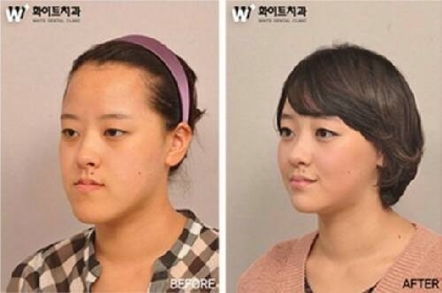 exo各种神级ps搞笑图,明帮搞笑图后对比照,ps后的搞笑 ...