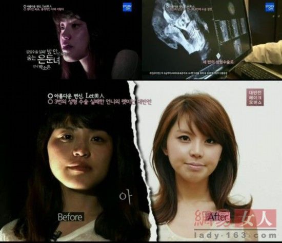 韩国整容节目真人秀:丑女变美人让人震惊(组图